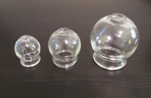 Cupping and moxibustion, image of Glass cups used in cupping therapy